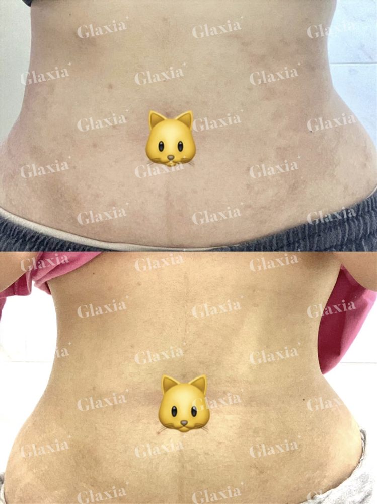 Glaxia before and after — customer result 3