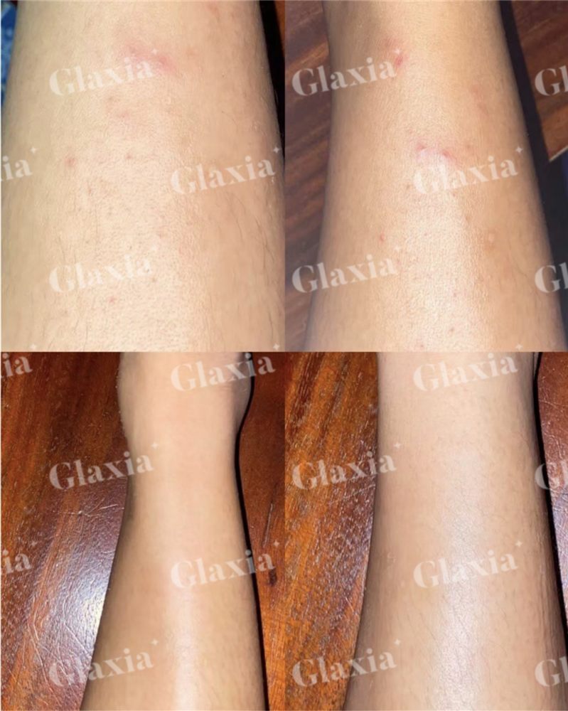 Glaxia before and after — customer result 4